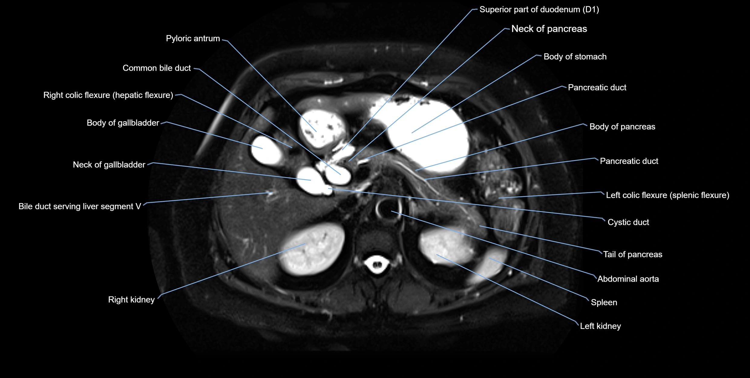 MRI MRCP axial cross sectional anatomy 3T radiology  image-img-10001-00020.webp